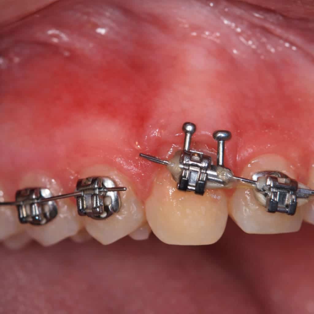 QUE FAIRE SI… je suis blessé(e) ?