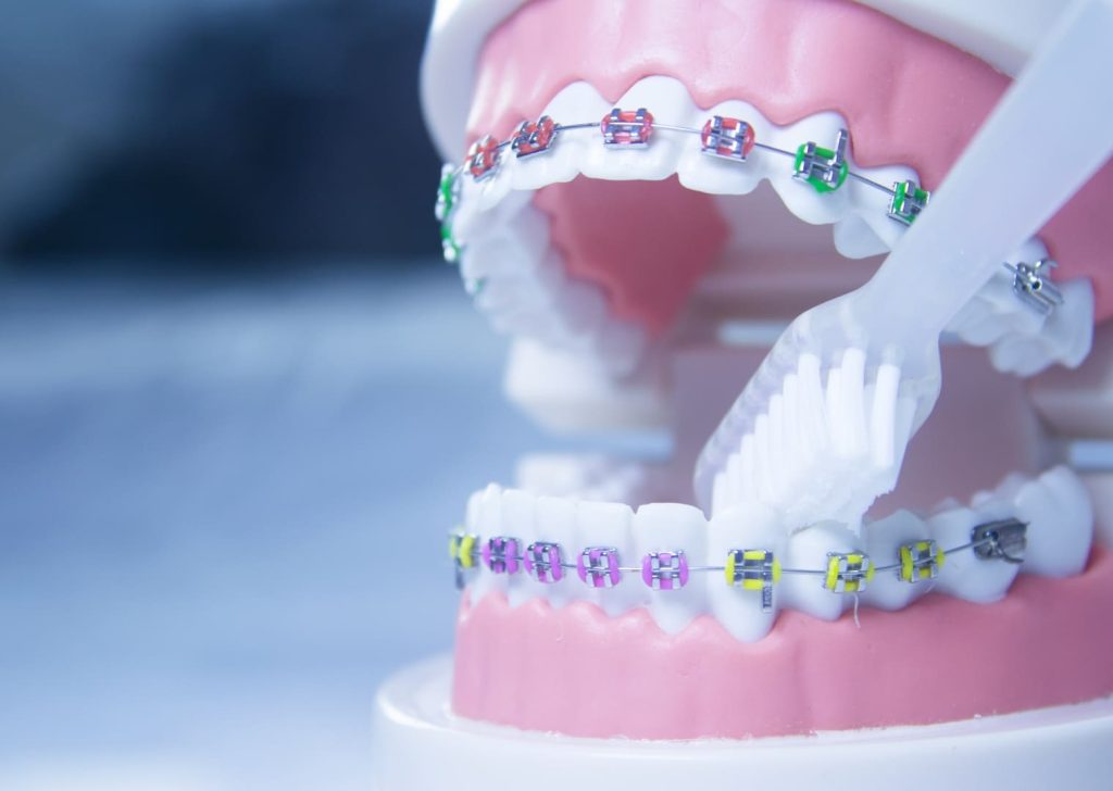 Hygiène bucco-dentaire irréprochable : un enjeu majeur